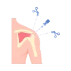 Complex orthopaedic problems