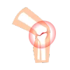 Knee Treatments